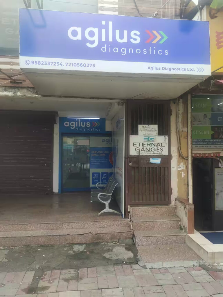 Labs for blood test